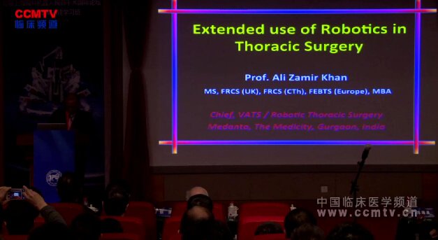 AZ Khan：胸外科机器人技术的扩展应用